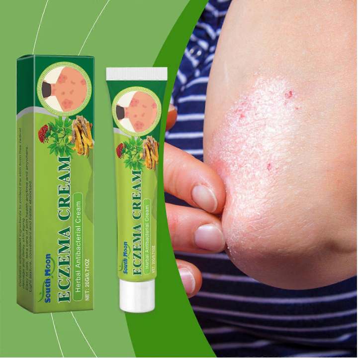 Eczema Treatment Cream