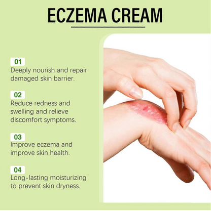 Eczema Treatment Cream